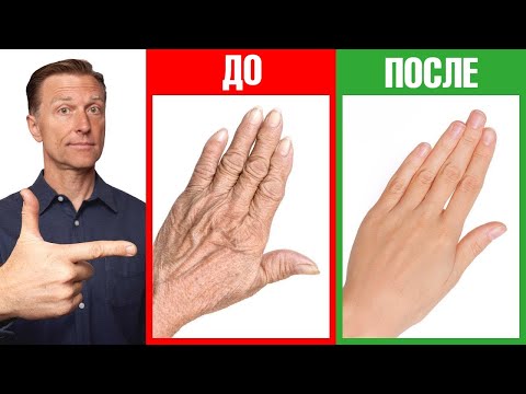 Видео: Сухость кожи рук и трещины на руках? Лучшее домашнее средство🔥