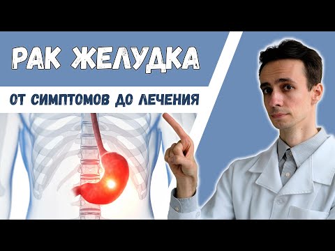 Видео: РАК ЖЕЛУДКА 🦀 Симптомы и признаки. Кто в группе риска. Как выявить и лечить.