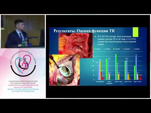 Видео: Защита диссертации Новиков А. В.