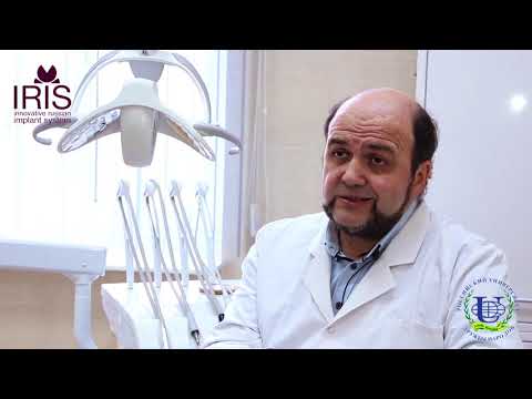Видео: Сколько стоит дентальная имплантация? От чего зависит цена?