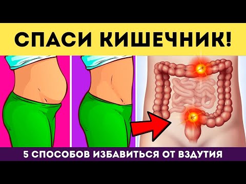 Видео: ТОП 3 упражнения от ВЗДУТИЯ ЖИВОТА • СПАСИ КИШЕЧНИК