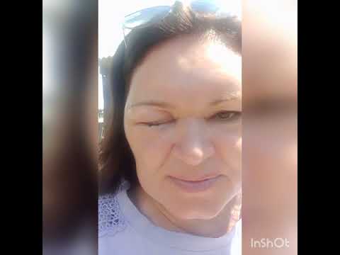 Видео: 16.07.22.Аллергия.Болезнь, после окрашивания волос.День третий.