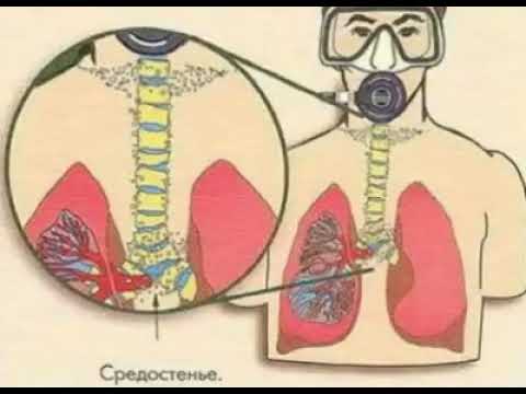 Видео: Баротравма легкого