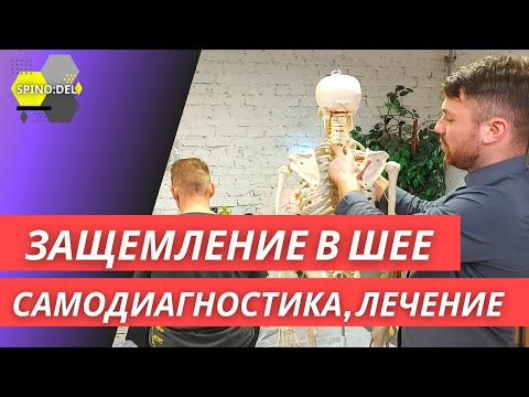 Видео: Шейный остеохондроз | Болит шея |