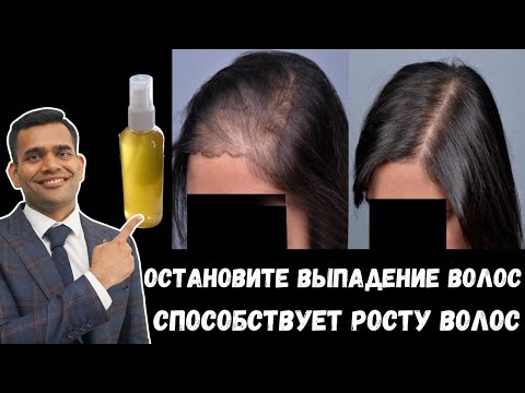 Видео: Способствует Росту Волос И Останавливает Выпадение
