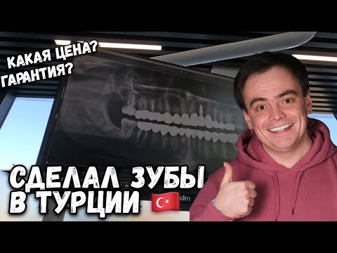 Видео: СДЕЛАЛ ЗУБЫ В ТУРЦИИ. СКОЛЬКО СТОИТ ГОЛЛИВУДСКАЯ УЛЫБКА?