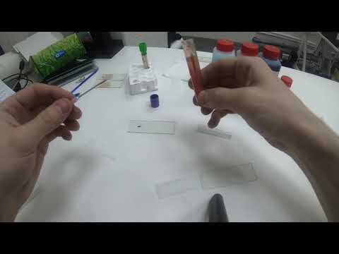 Видео: изготовление мазка крови