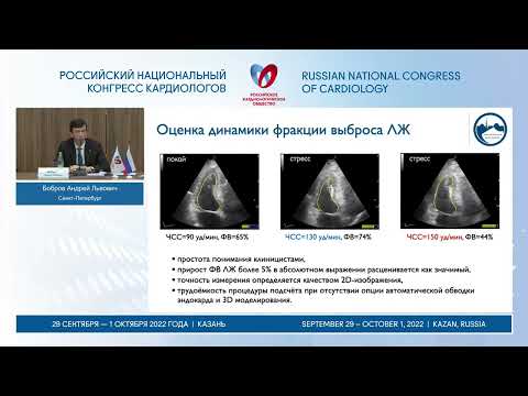 Видео: Возможности стресс-эхо в диагностике и определения выраженности сердечной недостаточности