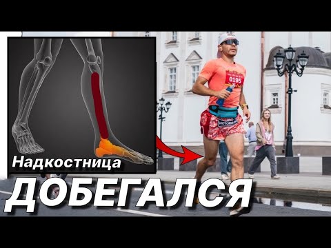 Видео: Воспаление НАДКОСТНИЦЫ. Как ВЫЛЕЧИТЬ и забыть об этом НАВСЕГДА