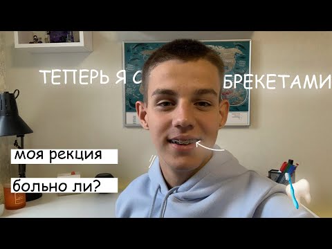 Видео: Мне поставили брекеты 🦷 | Первый опыт | Больно? | Мои впечетления