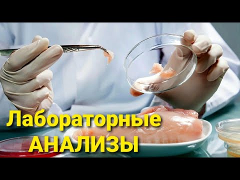 Видео: СКОЛЬКО "ХИМИИ" В ДОМАШНЕЙ КУРИЦЕ???