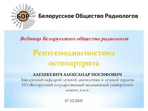 Видео: Рентгенодиагностика остеоартрита
