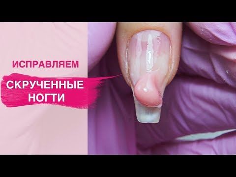 Видео: Исправляем СКРУЧЕННЫЕ ногти | Коррекция ногтей полигелем