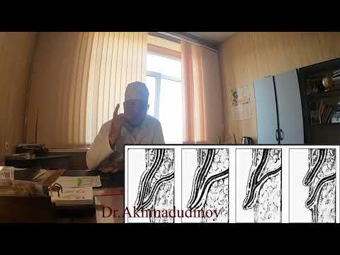 Видео: Топография органов брюшной полости. Часть 3. Проф. Ахмадудинов М.Г.