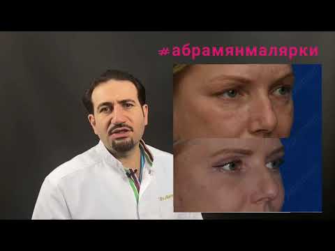 Видео: Малярные мешки или малряные жиры.