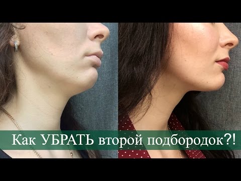 Видео: Как УБРАТЬ Второй подбородок! БЫСТРЫЙ и ЭФФЕКТИВНЫЙ способ!!!
