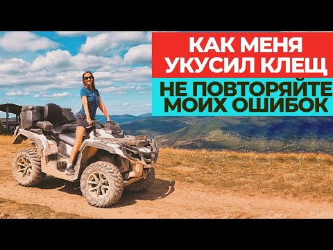 Видео: КАК МЕНЯ УКУСИЛ КЛЕЩ / БОЛЕЗНЬ ЛАЙМА. СИМПТОМЫ. ЛЕЧЕНИЕ / НЕ ПОВТОРЯЙТЕ МОИХ ОШИБОК