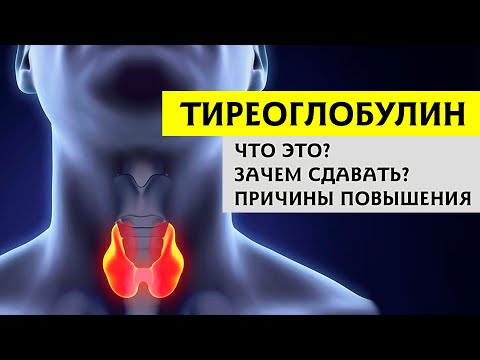 Видео: ТИРЕОГЛОБУЛИН: онкомаркер щитовидной железы. 🤔 Зачем нужно его проверять?