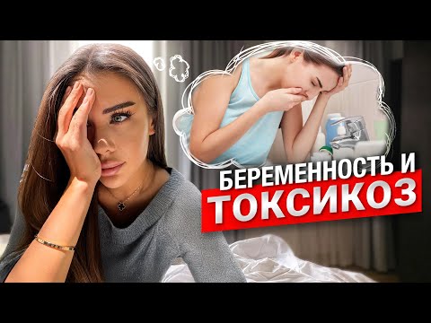 Видео: Токсикоз: Мой опыт и советы | Сравнение беременностей