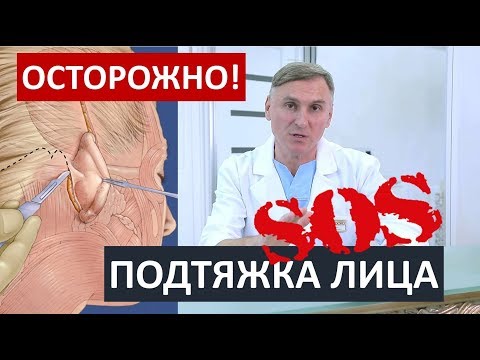 Видео: ПОДТЯЖКА ЛИЦА: 🆘 ОСЛОЖНЕНИЯ, О КОТОРЫХ ВАЖНО ЗНАТЬ!