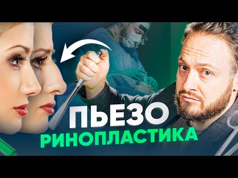 Видео: Как добиться идеального носа БЕЗ перелома костей? Пьезоринопластика