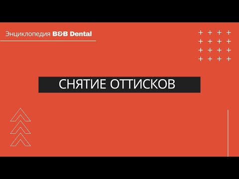 Видео: Снятие оттисков