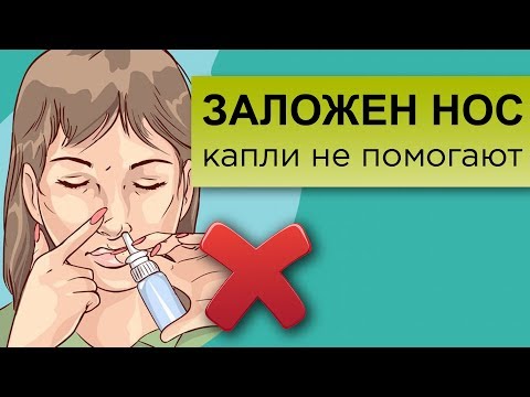 Видео: ЗАЛОЖЕННОСТЬ НОСА