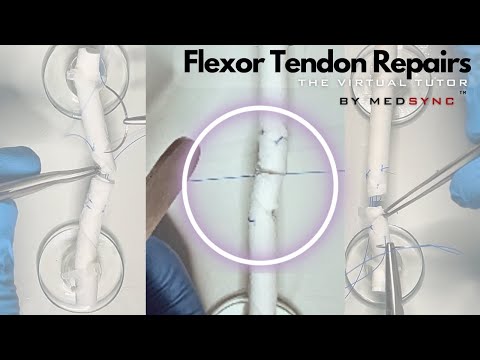 Видео: Швы сухожилий сгибателей: 3, которые вам НУЖНО знать!