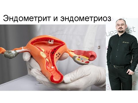 Видео: Воспаление матки – эндометрит и эндометриоз.