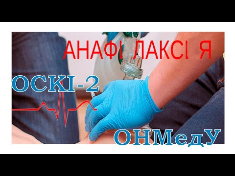 Видео: ОСКІ-2. "Невідкладний стан". Анафілаксія