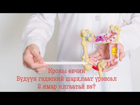 Видео: Кроны өвчин болон бүдүүн гэдэсний шархлаат үрэвсэл 2-н ялгаа
