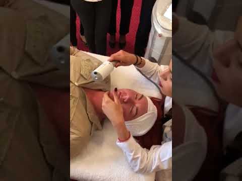 Видео: Процедура эндосферотерапии лица от Сильвии Боцелли