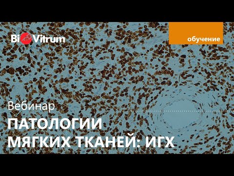 Видео: ИГХ-исследования при патологии мягких тканей