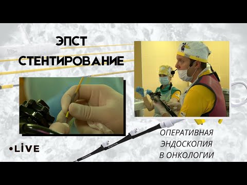 Видео: Прямая трансляция из МКНЦ им. А.С. Логинова. ЭПСТ, стентирование протоков