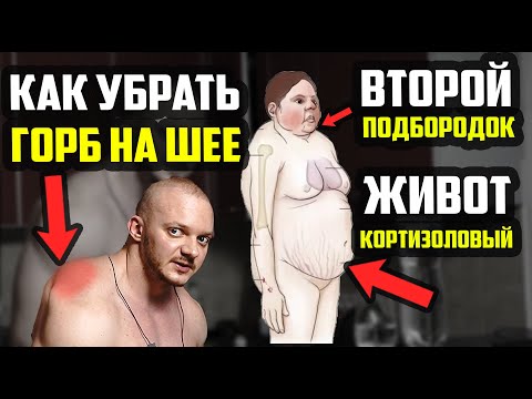 Видео: КОРТИЗОЛОВЫЙ ЖИВОТ И ПОДБОРОДОК НЕ УХОДИТ - РАСТЕТ ГОРБ НА ШЕЕ |СИМПТОМЫ СИНДРОМА СТРЕССОВОГО ЖИВОТА