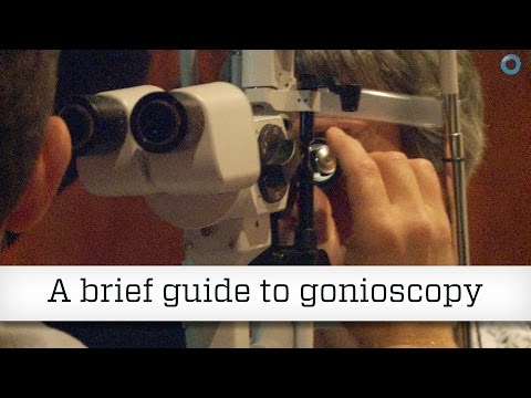 Видео: Краткое руководство по гониоскопии