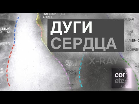 Видео: Рентген сердца: Дуги.