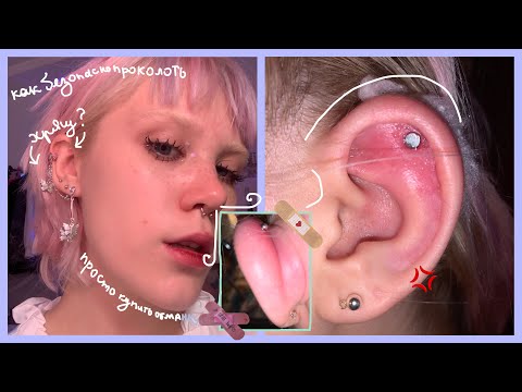 Видео: проколола хрящ и занесла инфекцию✨🍰