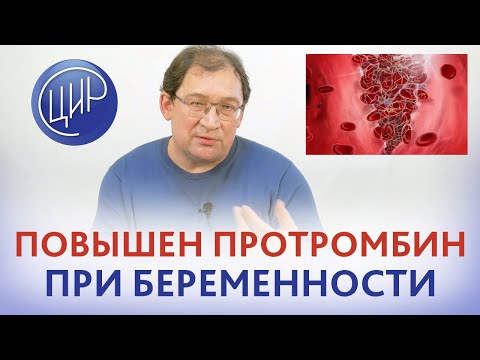 Видео: Повышен протромбин при беременности. В чём причина повышения протромбина при беременности?