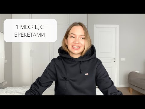 Видео: 1 МЕСЯЦ С БРЕКЕТАМИ 😬: УЖЕ ВЫРАВНИВАЕТСЯ? | ПИТАНИЕ