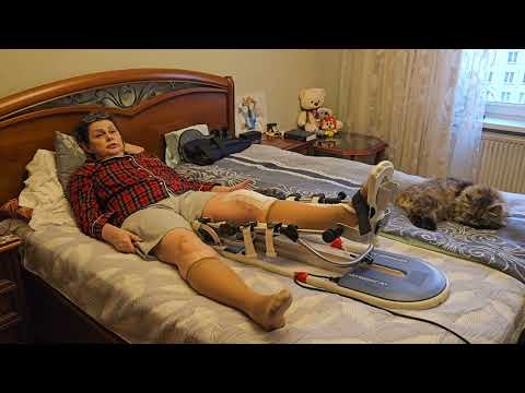 Видео: Отзыв Елены после эндопротезирования.