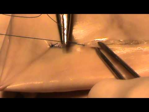 Видео: Кишечный шов Плахотина-Садовского. Docent A.D. Stepanov, ПДАТУ