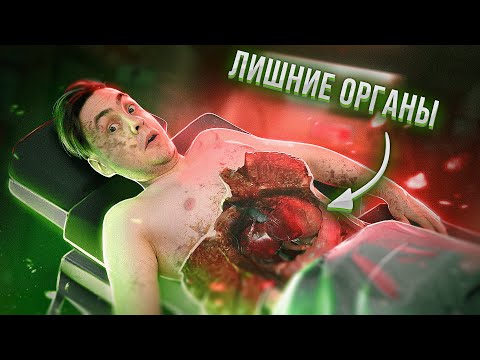 Видео: Каково жить без: Легкого, Желудка, Щитовидки, Селезёнки итд?