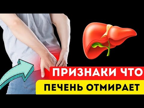Видео: ВОТ ранних 13 ПРИЗНАКОВ того, что ваша ПЕЧЕНЬ отмирает. Многие люди даже НЕ Догадываются...