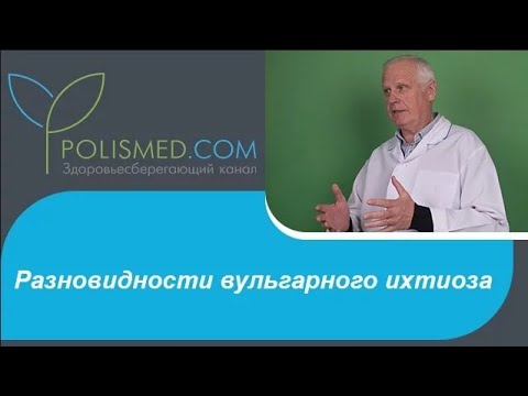 Видео: Разновидности вульгарного ихтиоза вульгарный, простой, абортивный, роговидный, блестящий