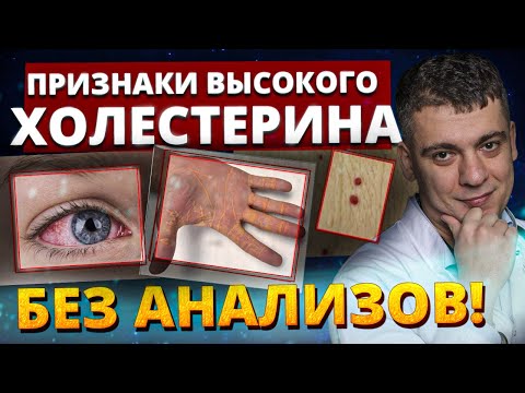 Видео: ВЫСОКИЙ ХОЛЕСТЕРИН! 5 ТРЕВОЖНЫХ признаков, ОПРЕДЕЛИТЕ  ДОМА даже БЕЗ ВРАЧЕЙ!
