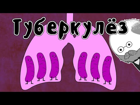 Видео: Лечение Туберкулеза - Мудреныч (Роберт Кох, история на пальцах)