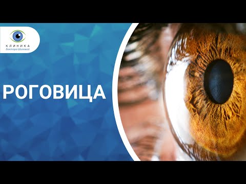 Видео: Прозрение Роговица 1 часть
