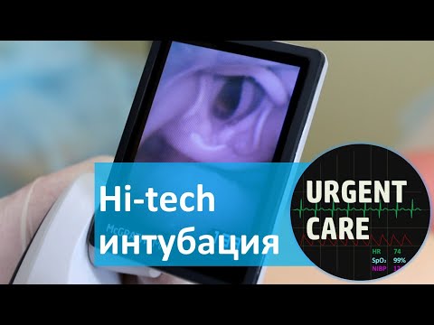 Видео: Интубация трахеи: Видеоларингоскоп, Эндоскоп