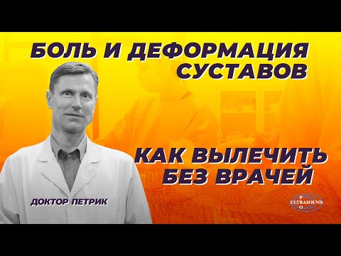 Видео: Боль и деформация суставов. Как вылечить без врачей.